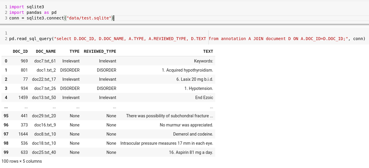 sqlite data view